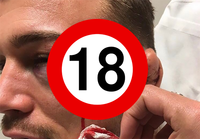 Brutális árkot szántott Daley térde Ward fejébe (18+)