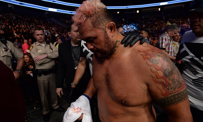 Mark Hunt arról posztolt, hogy eltört a sípcsontja a hétvégi Overeem-meccsen. Ennyire azért nem rossz a helyzet