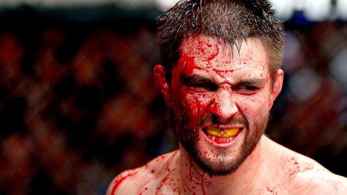 A visszatérő Carlos Condit visszavágót akar GSP és Woodley ellen