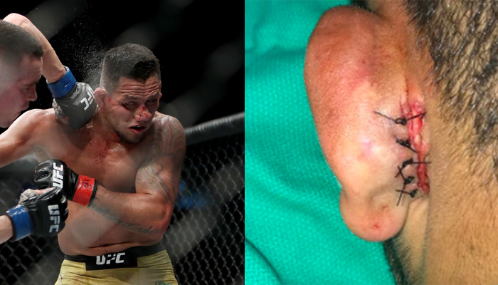 RDA nem csak az átmeneti 170 fontos övet bukta Kolbi ellen, hanem majdnem mást is...