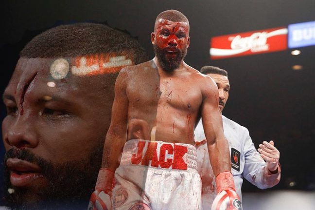 Minden szakadások ősanyjával bokszolta végig meccsét Badou Jack, de sajnos sikertelenül...