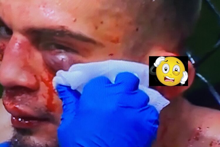 Kaptunk éjjel egy emlékeztetőt arról, mennyire brutális is az MMA