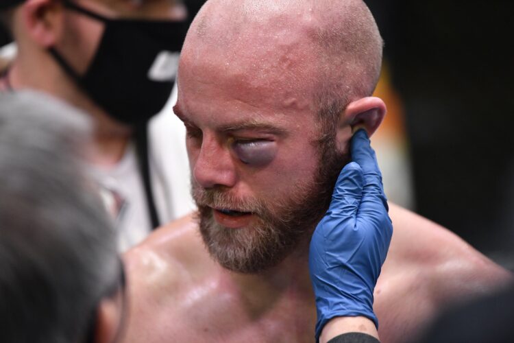 Horrorsérülés miatt kellett véget vetni egy meccsnek a hétvégi UFC-gálán