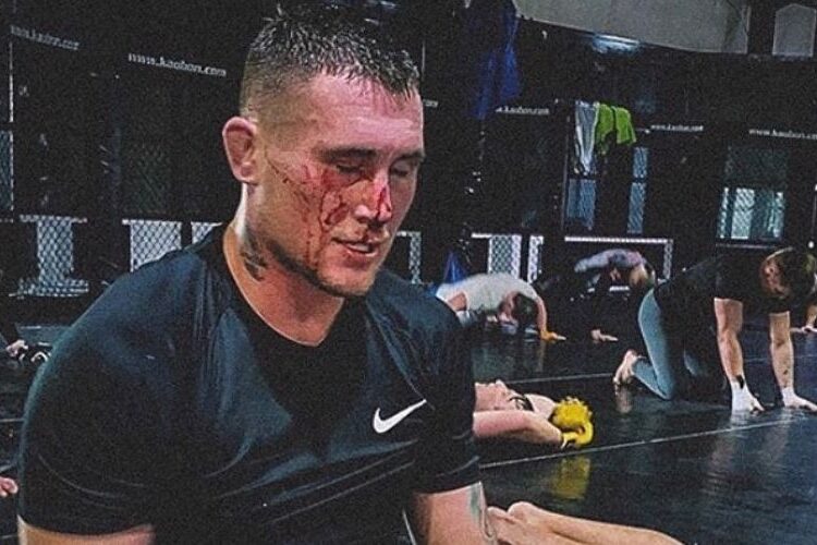 Darren Till eltörte a kulcscsontját, off a Vettori elleni meccse