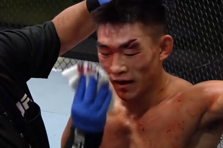 Csúnya sérülés vetett véget Sandhagen és Yadong meccsének