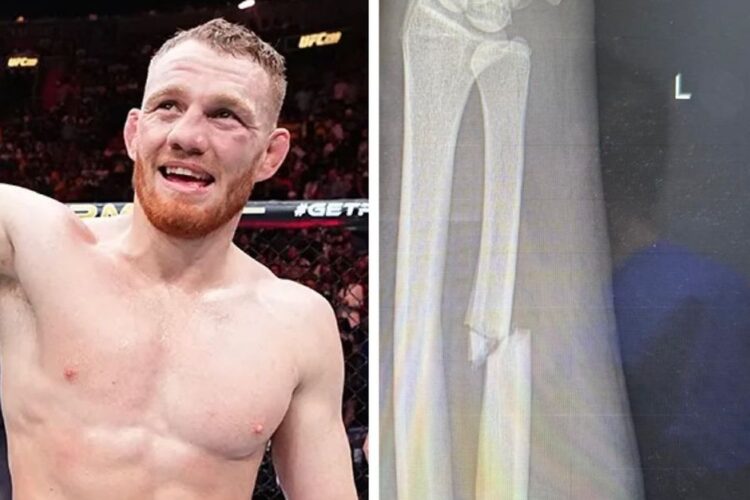 Most derült ki: Jack Della Maddalena karja már az elsőben ELTÖRT Gilbert Burns ellen