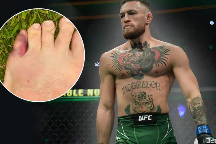 Conor McGregor eltörte a lábujját, megígérte, hogy visszatér