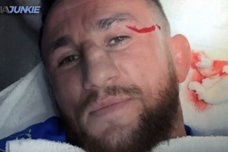 Merab Dvalishvili szemöldöke megsérült, pár héttel a UFC 306 előtt