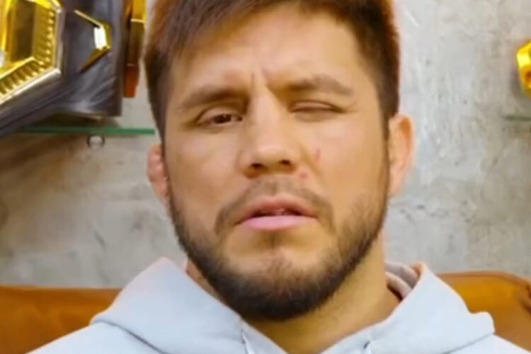 Henry Cejudo szemsérülése még komolyabb, mint hittük