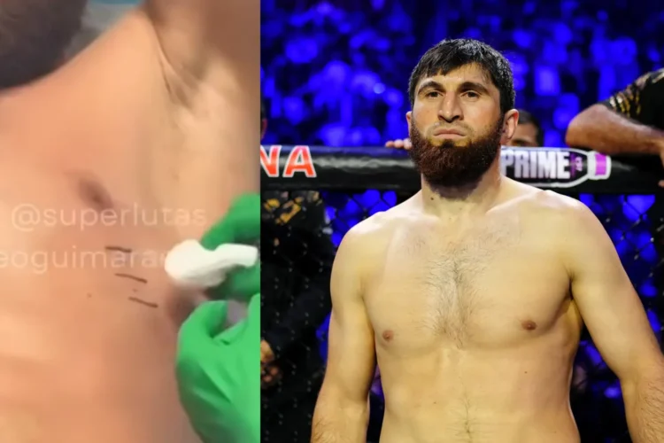 Magomed Ankalaev bordatörést szenvedett a UFC 320 előtt