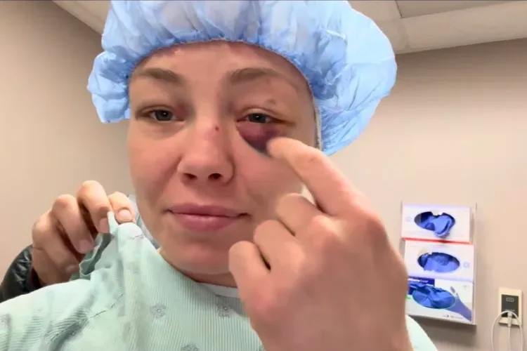 Rose Namajunast műteni kellett, mert a UFC 324-en többször is szemébe nyúltak